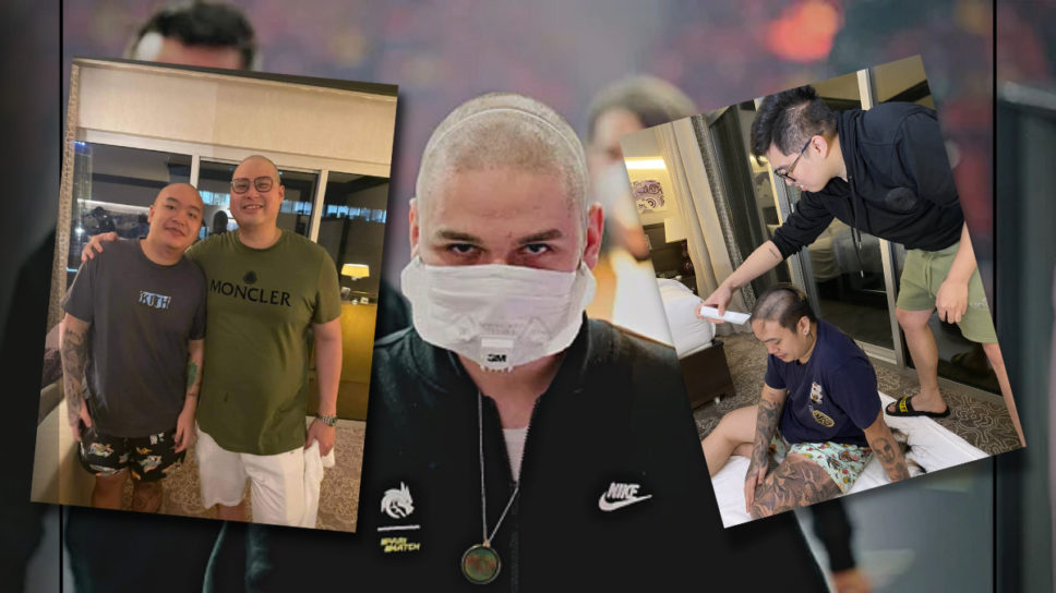 TI11 players are shaving their heads to gain the “Yatoro buff” cover image
